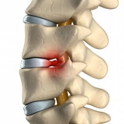 болит голова и отдает в шею с левой стороны болит плечо и рука