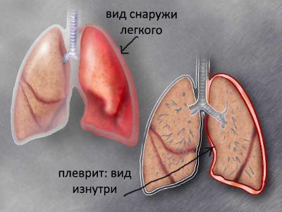 Часто болит правый бок и отдает в спину