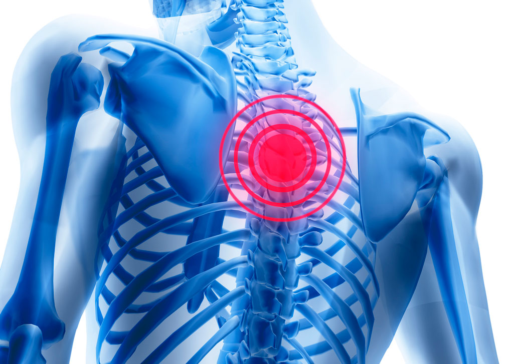 Болит спина в области лопаток врачи