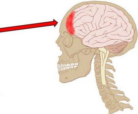 болит голова лобная часть что делать