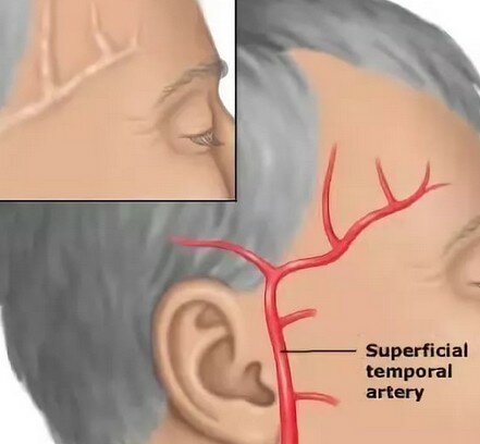 Болит правый висок головы почему