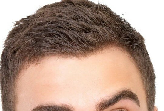 болит голова от брови до затылка