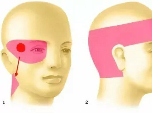 если болит глаз и одна половина головы