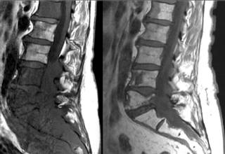 На спине шишка которая болит что это