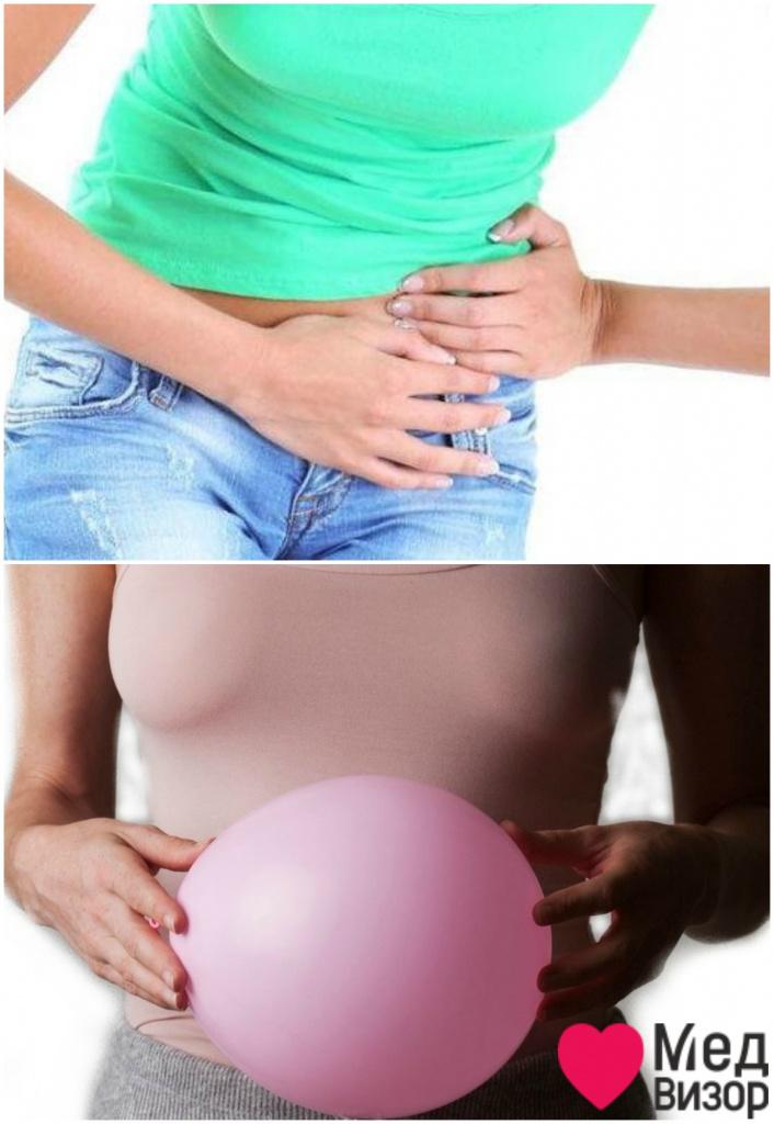 Дивертикулез симптомы: боли в нижней левой части живота, могут отдавать в спину; вздутие живота Болит спина внизу понос