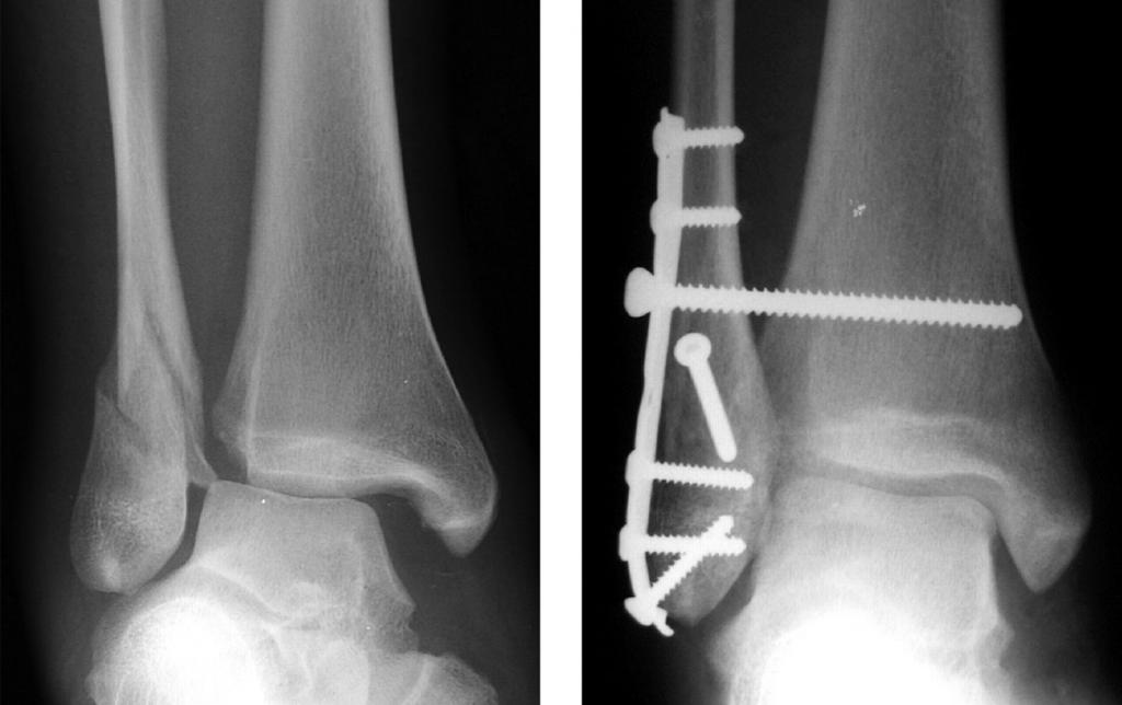 Оперативный метод лечения
