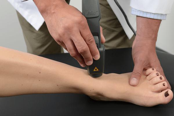 Лазерная терапия