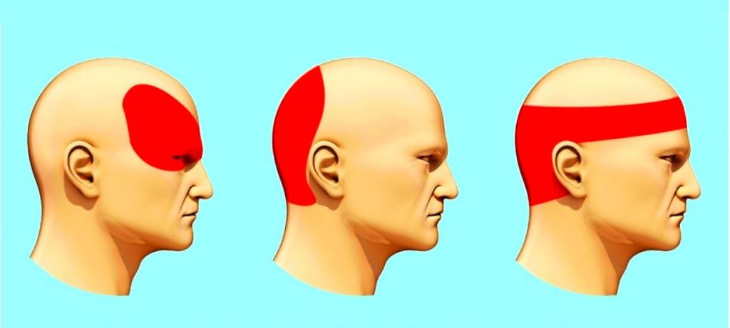 болит голова сзади уха