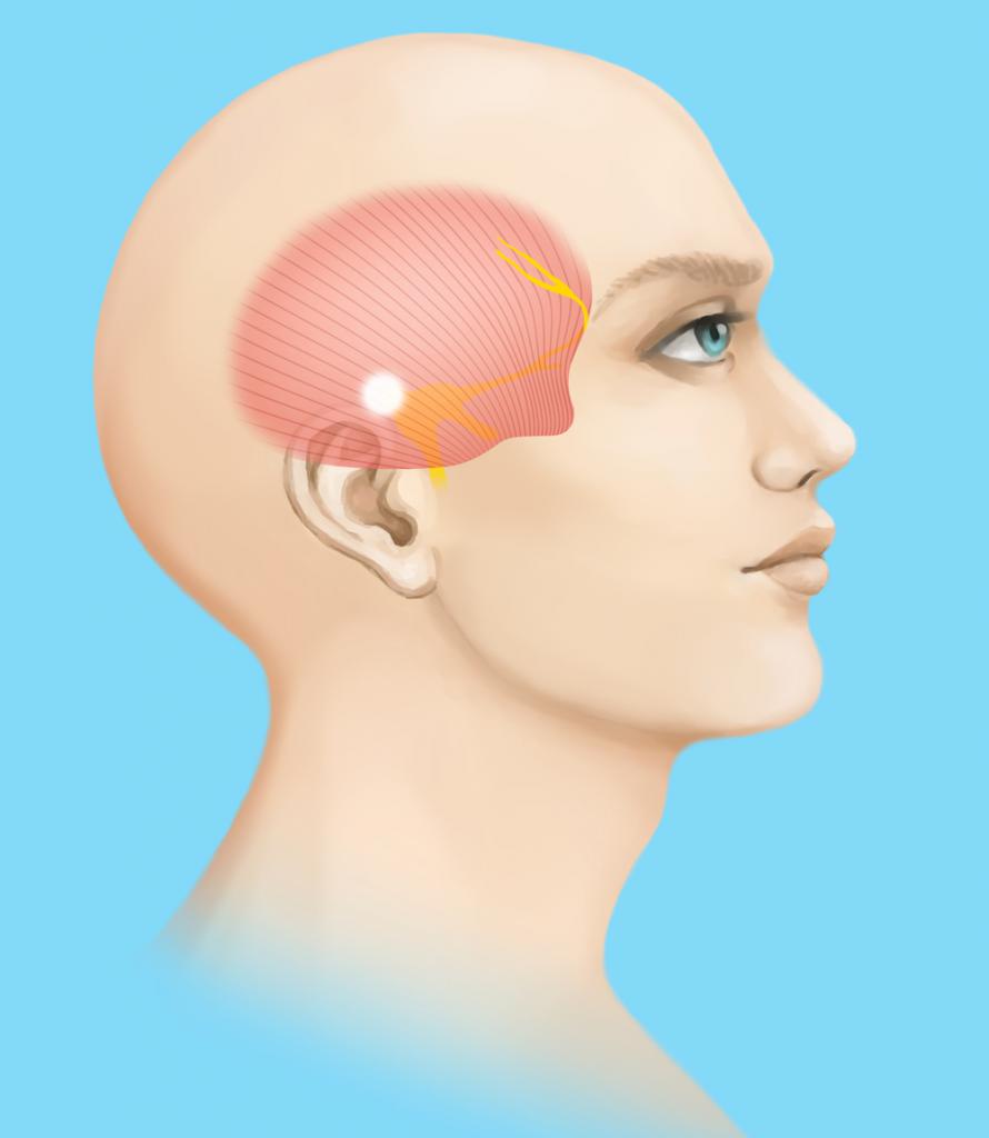 болит голова над ухом