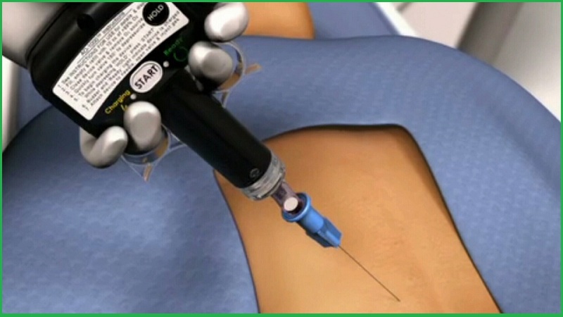 упражнения лфк при грыже поясничного отдела позвоночника