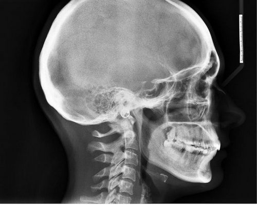 Встаю болит голова что такое