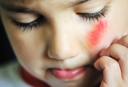 ссадина на спине красная и болит