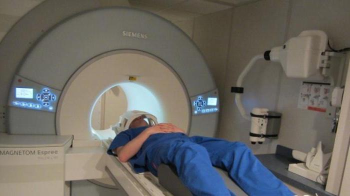 сильная боль в затылке и висках