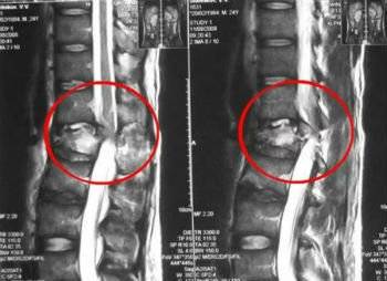 Когда наклоняешь голову вперед болит спина