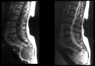 На спине шишка которая болит что это