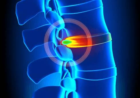 болит спина в области лопаток и шеи и голова