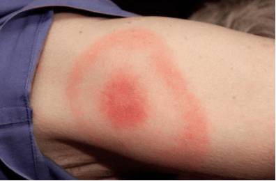 Голова болит упадок сил