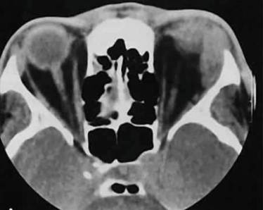 Температура и болит правая сторона спины