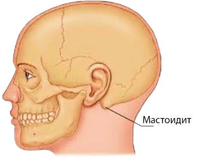 болит спина и шея за ушами