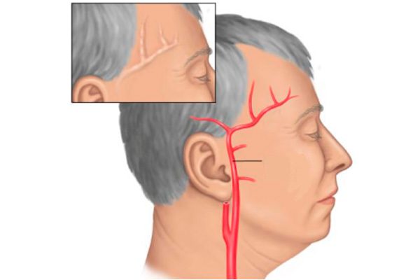 Сильно болит голова лекарства не помогают что