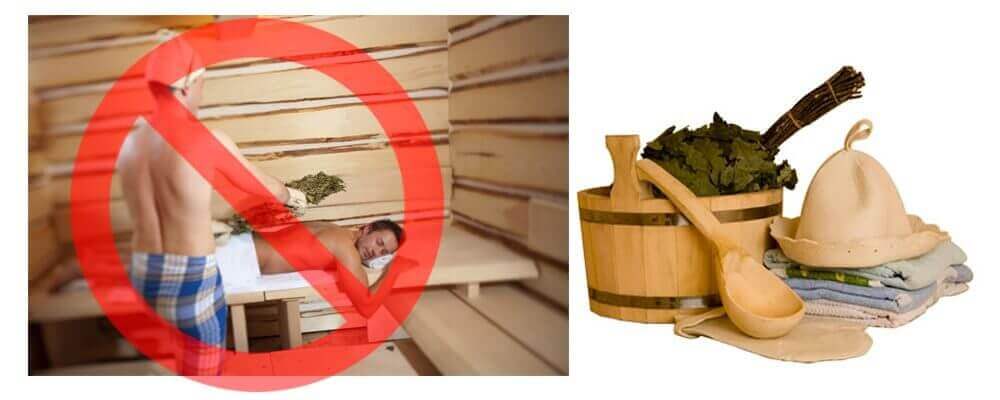 Походы в баню запрещены при ущемлении нерва