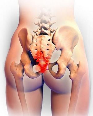 ???? Болезненные ощущения в пояснице и спине при геморрое ???? Боли в пояснице и спине при геморрое - причины и лечение