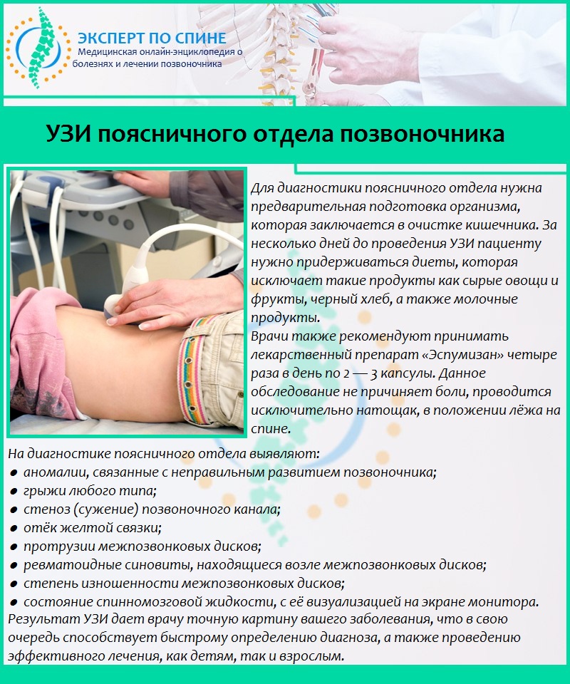 УЗИ поясничного отдела позвоночника