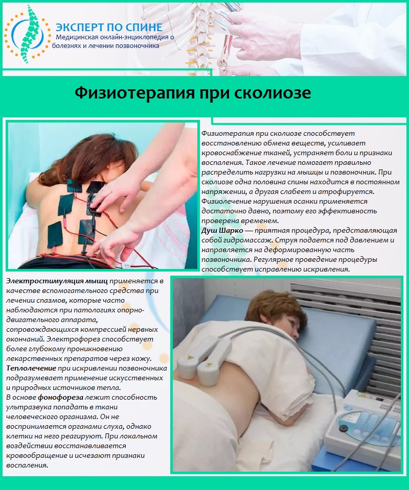 Физиотерапия при сколиозе