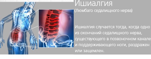 Почему возникают неприятные ощущения в пояснице Почему возникают неприятные ощущения в пояснице