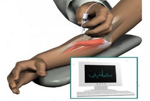 Электромиография Электромиография