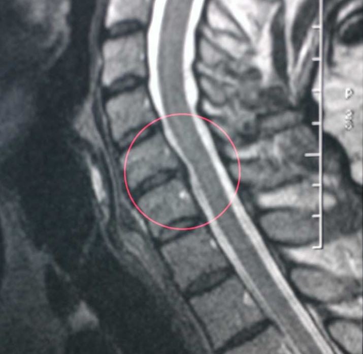 Звенит в голове болит шея