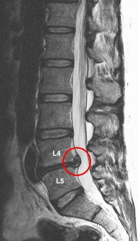 У меня болит спина справа