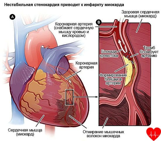 У меня болит спина справа