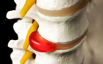 болит голова и отдает в шею с левой стороны болит плечо и рука