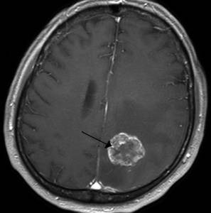 Голова болит упадок сил
