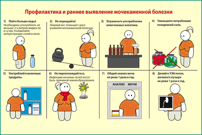 Профилактика мочекаменной болезни Профилактика и раннее выявление болезни