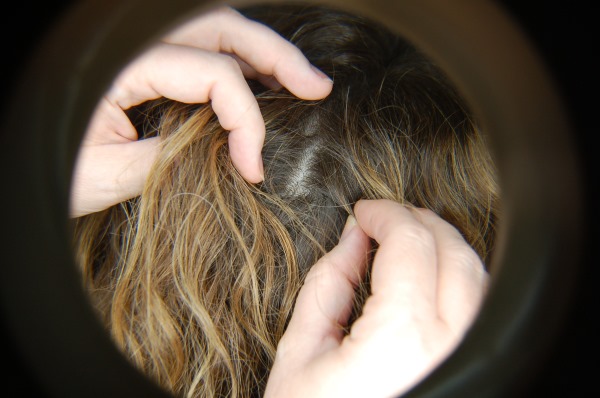 Шишка на голове. Что это может быть, если сзади, под кожей не болит, твердая на затылке. Причины, как избавиться, к какому врачу обращаться