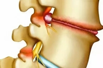 Когда наклоняешь голову вперед болит спина