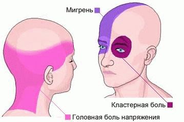 Сильно болит голова лекарства не помогают что